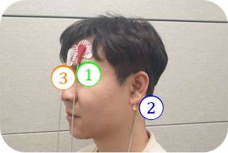 EEG 측정 예시 — 전극 부착 위치